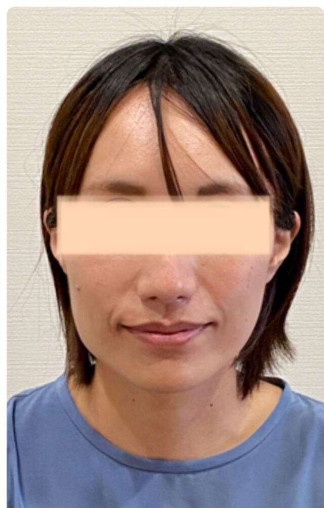 before画像