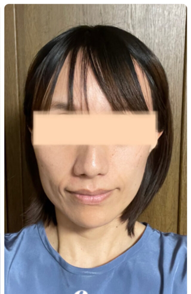 after画像