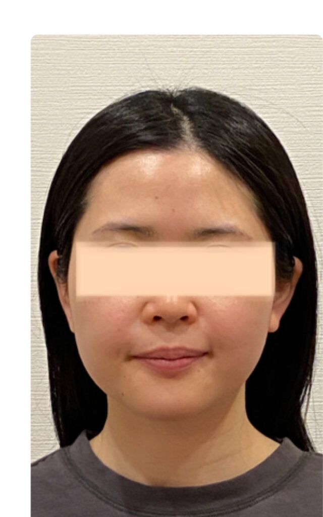 before画像