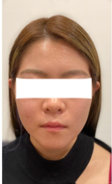 before画像