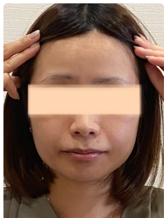 before画像