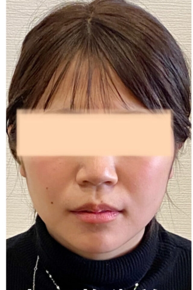before画像